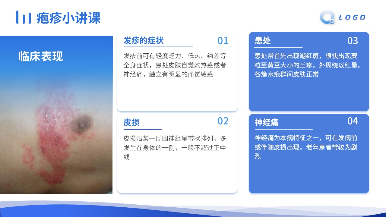 68-疱疹的护理查房第16页预览