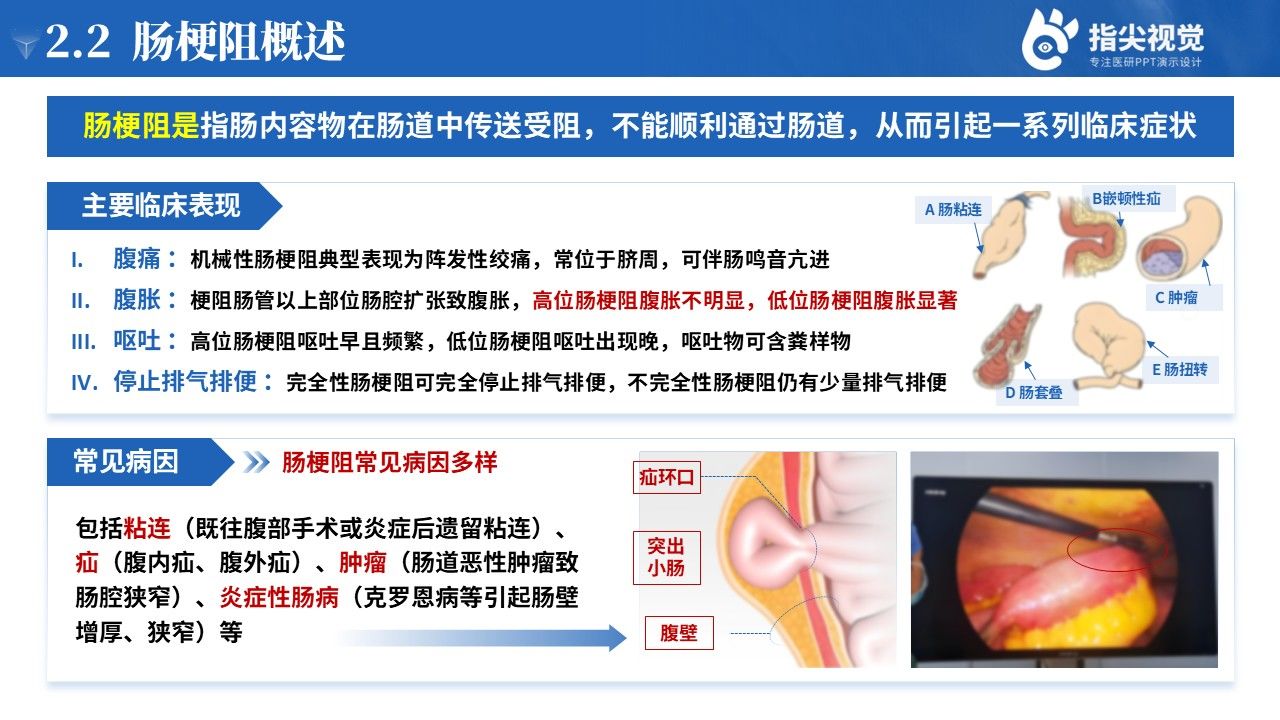 110期-护理个案-肠梗阻个案护理(蓝色)第5页预览