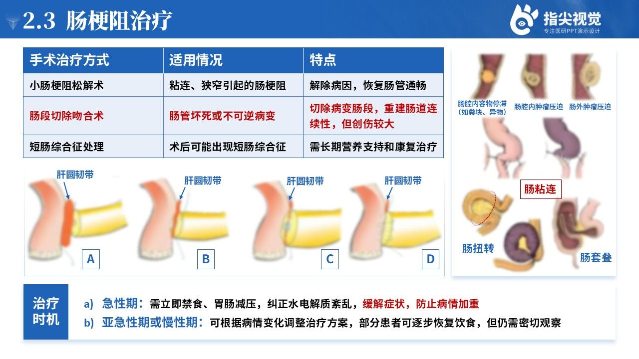 110期-护理个案-肠梗阻个案护理(蓝色)第6页预览