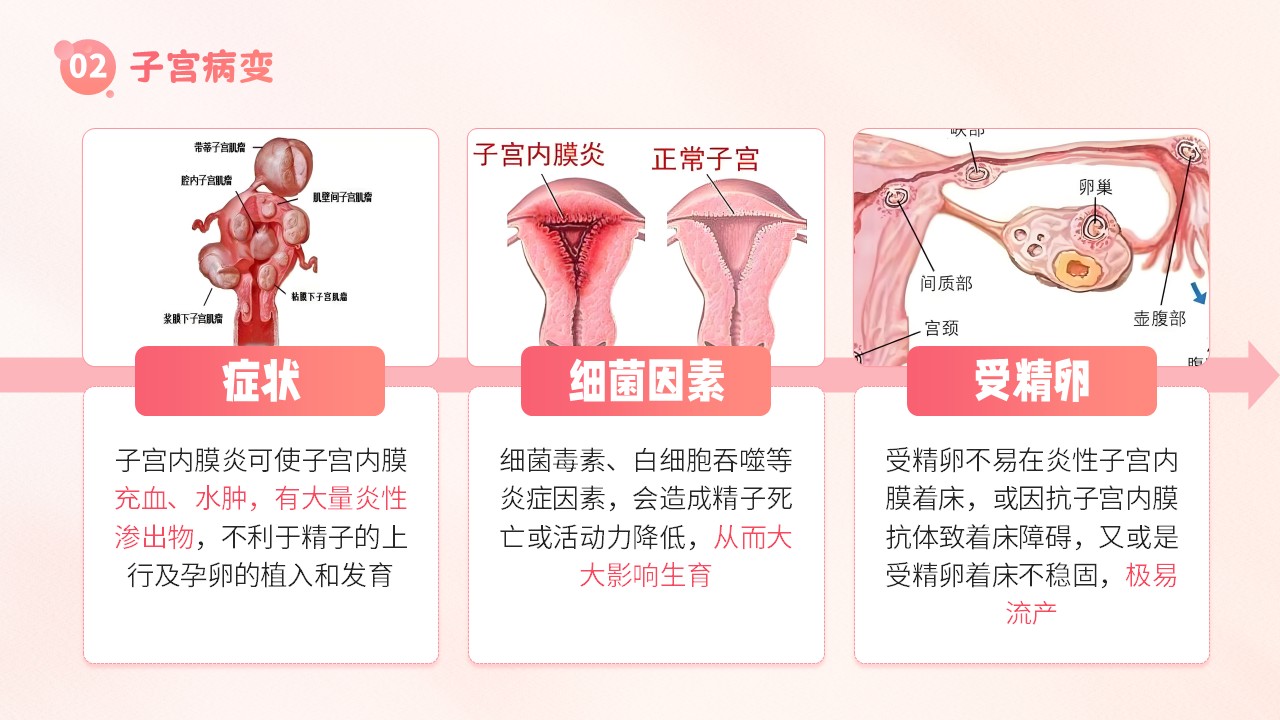 19-子宫内膜护理第10页预览