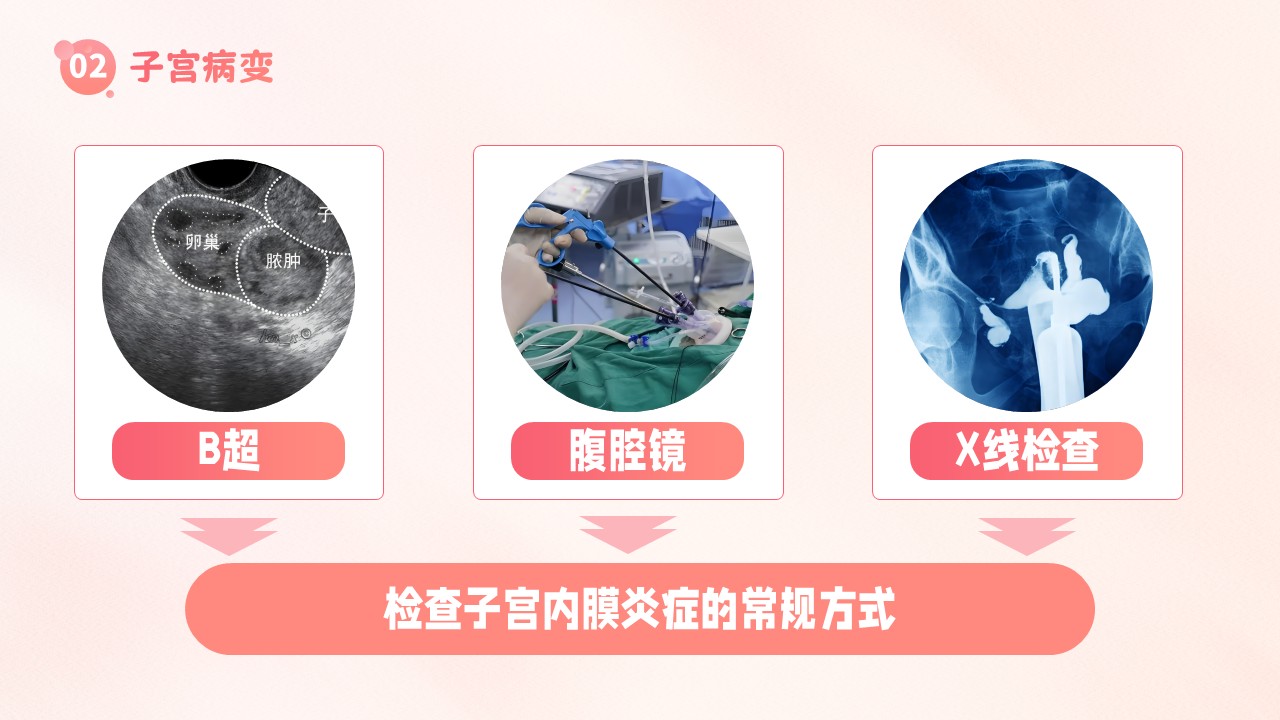 19-子宫内膜护理第14页预览