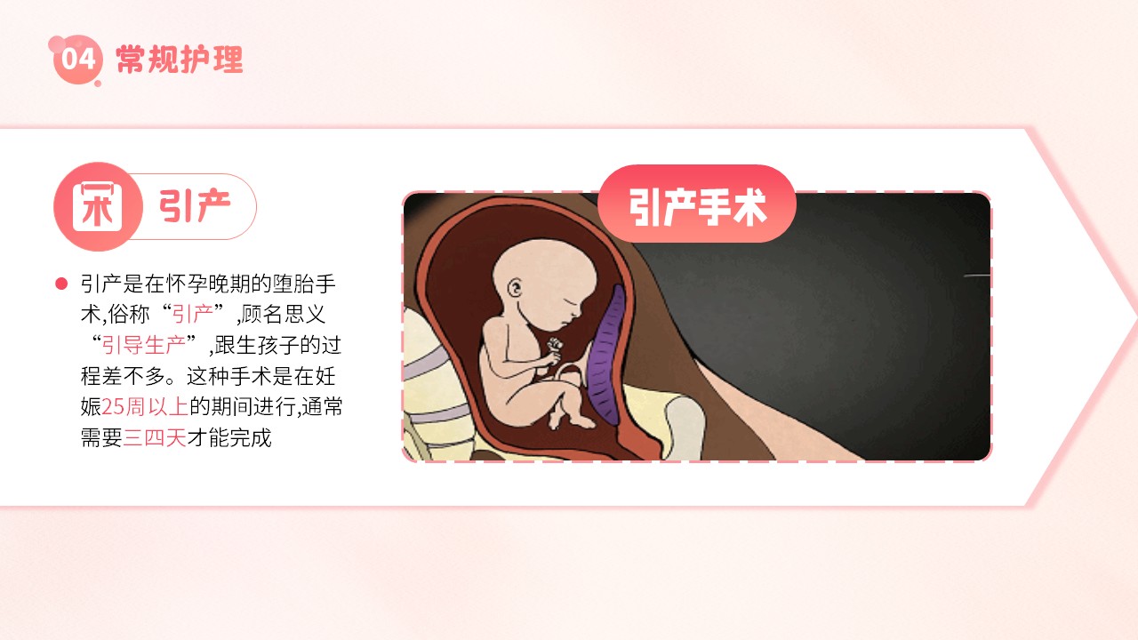 19-子宫内膜护理第23页预览