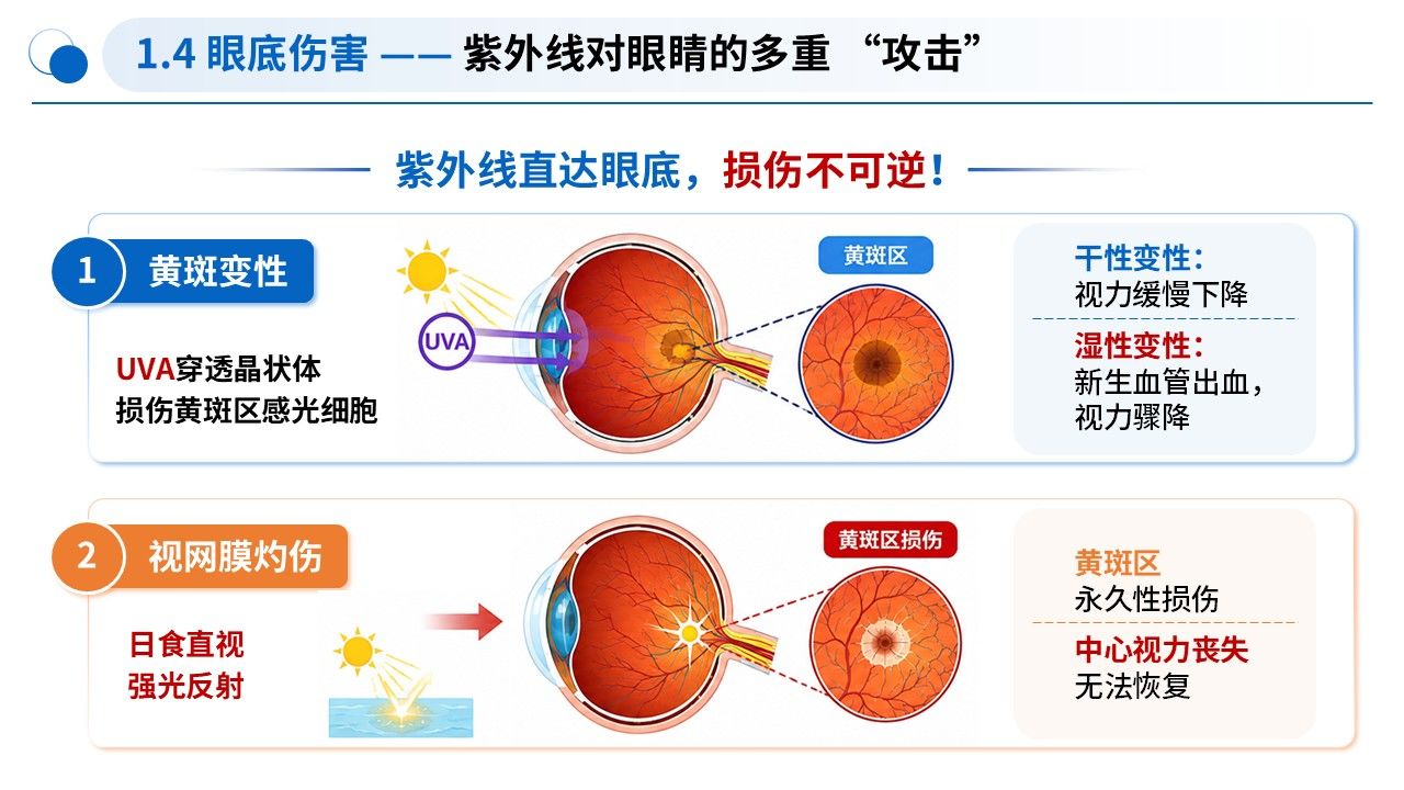 99-科普宣教—高温紫外线护眼科普第7页预览