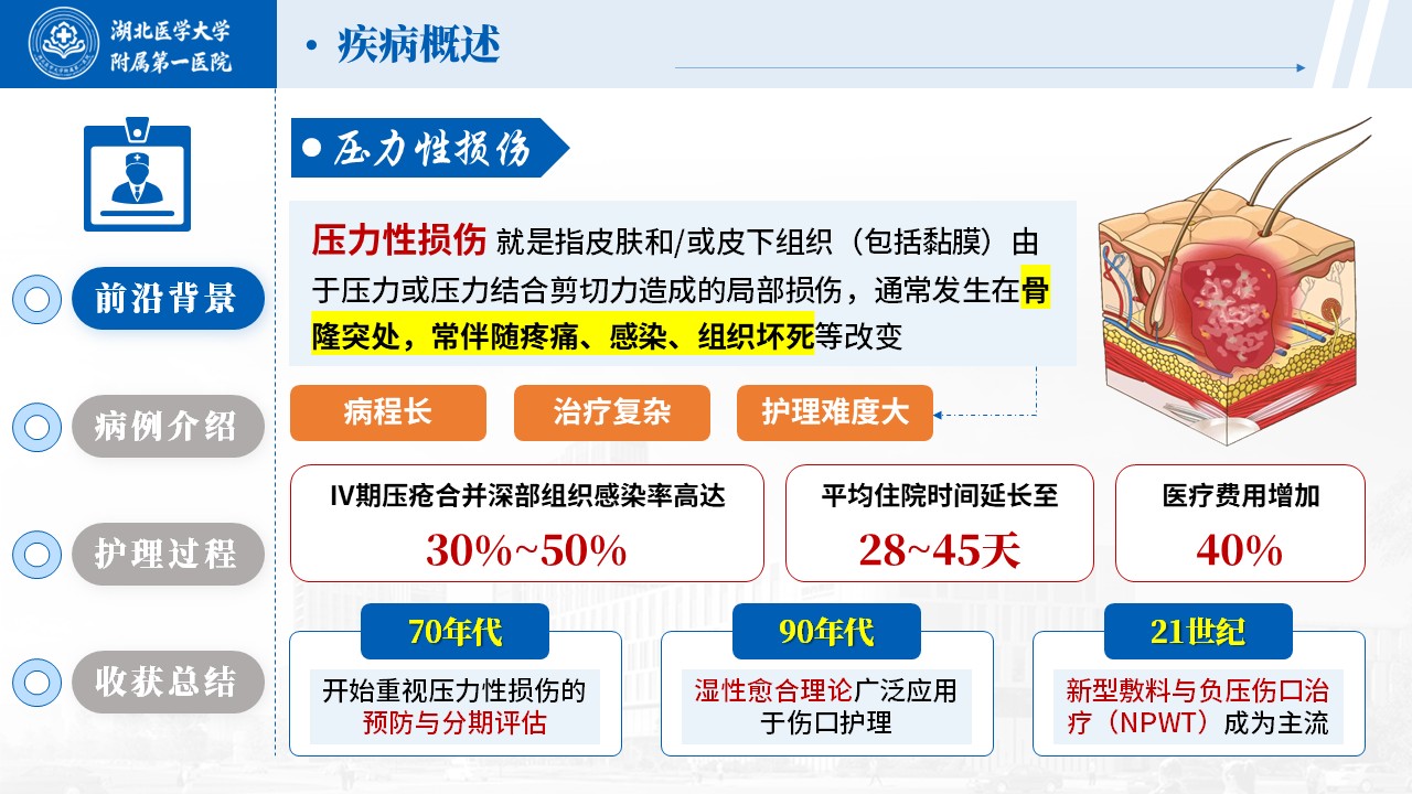 514期-护理个案-一例骶尾部 Ⅳ 期压力性损伤的伤口护理个案第3页预览
