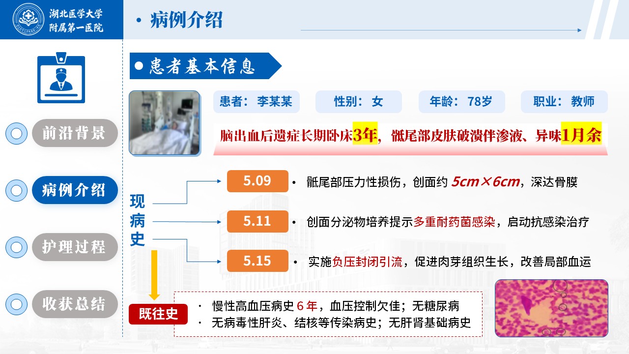 514期-护理个案-一例骶尾部 Ⅳ 期压力性损伤的伤口护理个案第6页预览