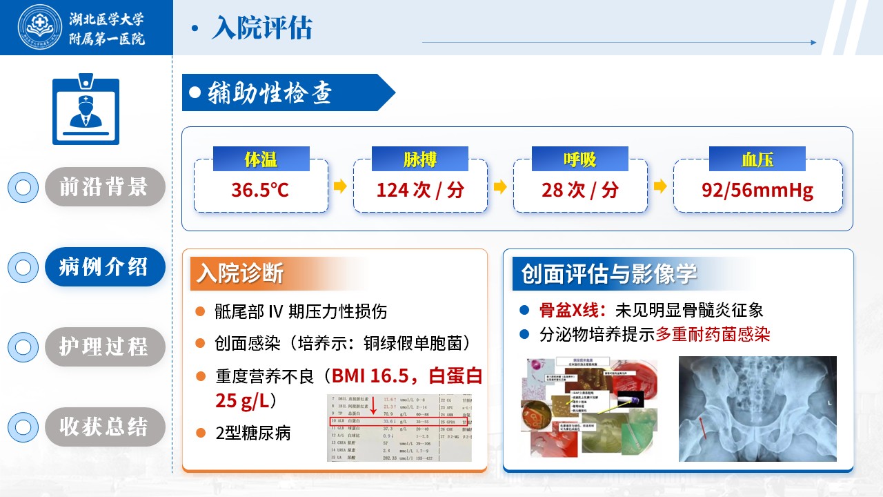 514期-护理个案-一例骶尾部 Ⅳ 期压力性损伤的伤口护理个案第7页预览