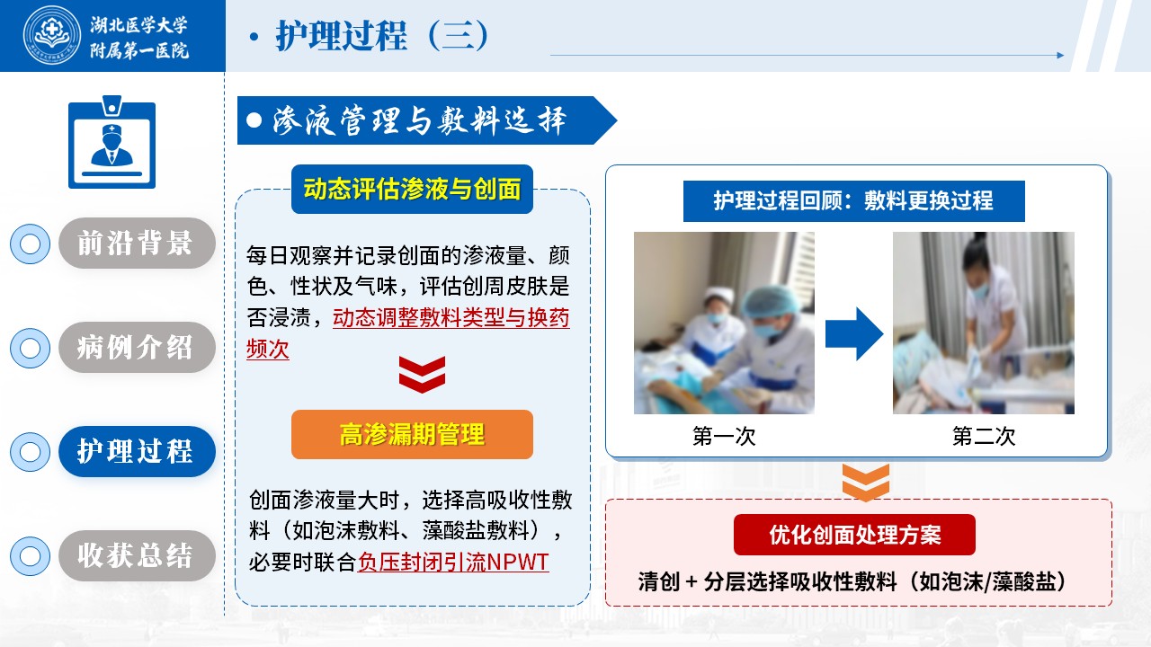 514期-护理个案-一例骶尾部 Ⅳ 期压力性损伤的伤口护理个案第13页预览