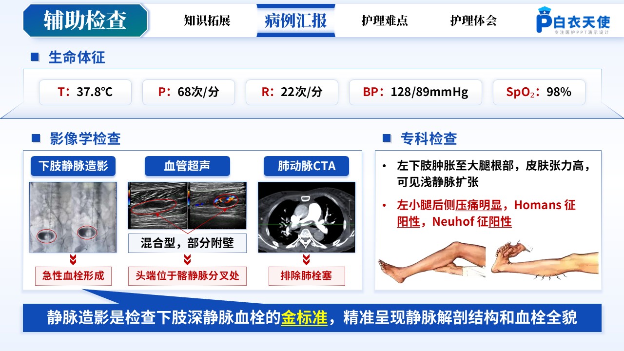158期-疑难病例讨论-下肢深静脉血栓 第6页预览