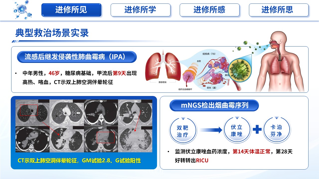 468期-进修汇报-呼吸与危重症医学科重症CAP进修汇报第7页预览