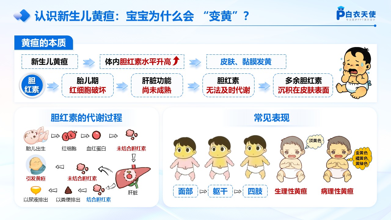 62-新生儿黄疸健康宣教第3页预览