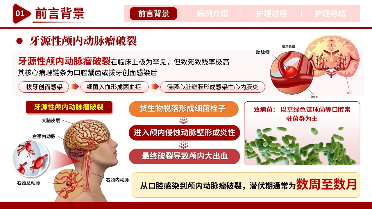 512期-护理个案-一例牙源性颅内动脉瘤破裂患儿的护理个案第3页预览