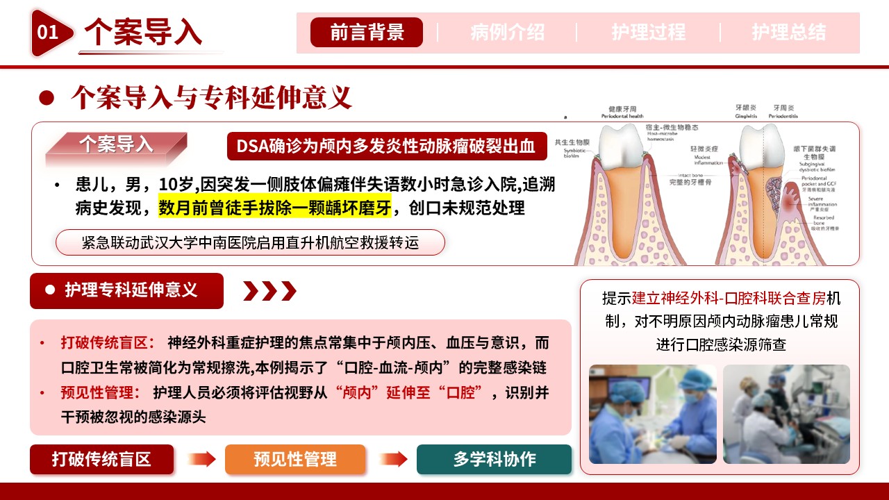 512期-护理个案-一例牙源性颅内动脉瘤破裂患儿的护理个案第4页预览