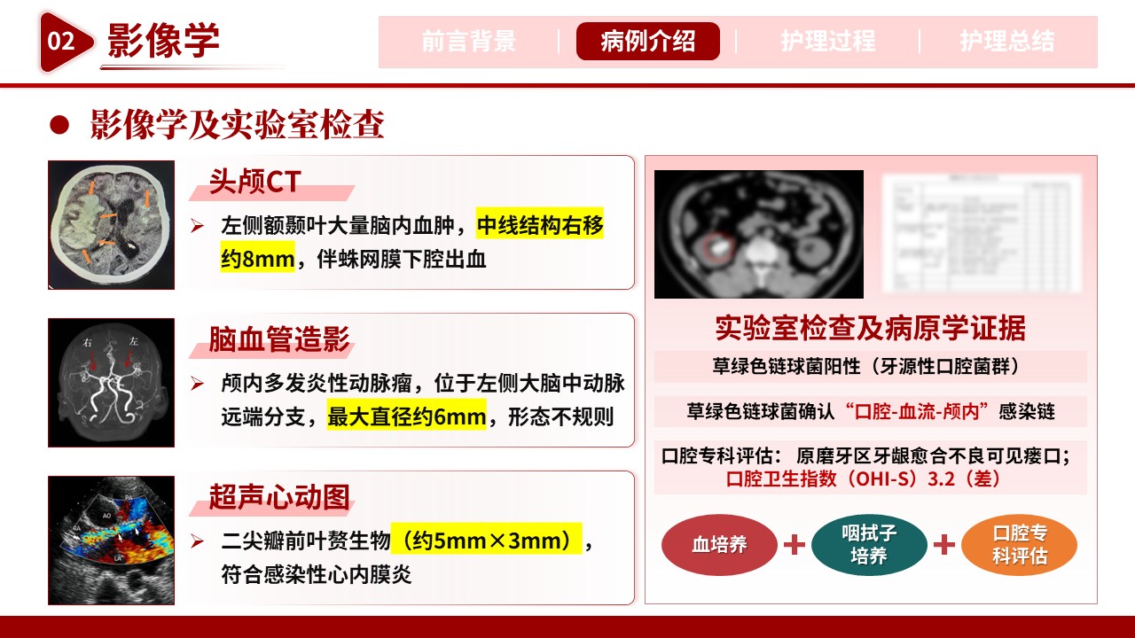 512期-护理个案-一例牙源性颅内动脉瘤破裂患儿的护理个案第7页预览
