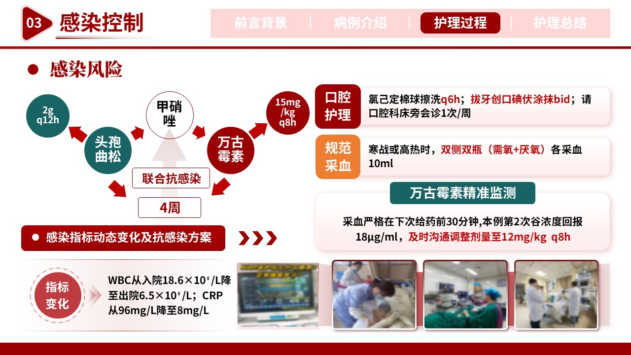512期-护理个案-一例牙源性颅内动脉瘤破裂患儿的护理个案第11页预览