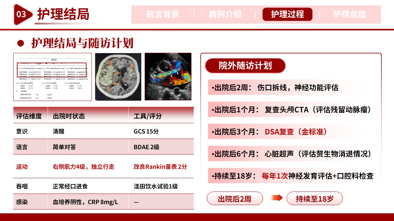 512期-护理个案-一例牙源性颅内动脉瘤破裂患儿的护理个案第13页预览