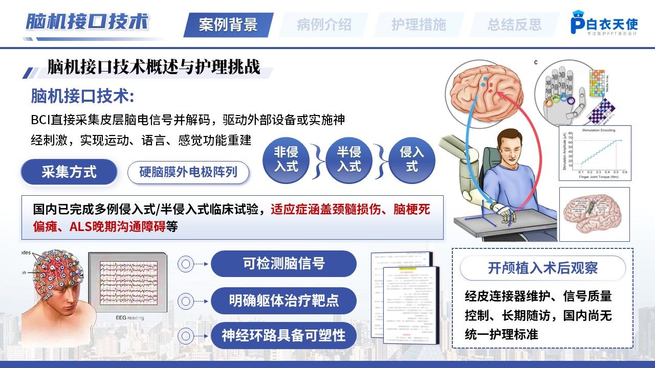 525期-疑难病例讨论-一例脑机接口植入术后患者的疑难病例讨论第3页预览