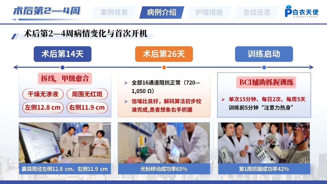 525期-疑难病例讨论-一例脑机接口植入术后患者的疑难病例讨论第8页预览