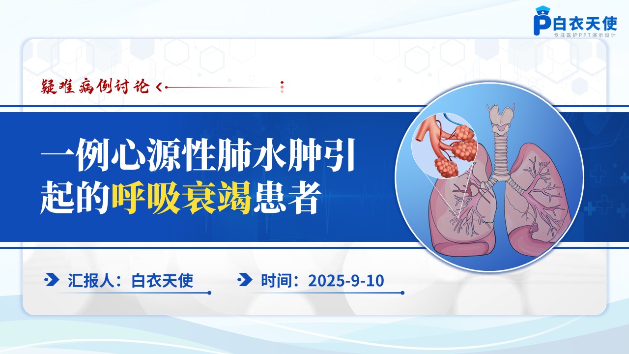 180期-疑难病例讨论-一例心源性肺水肿引起的呼吸衰竭患者
