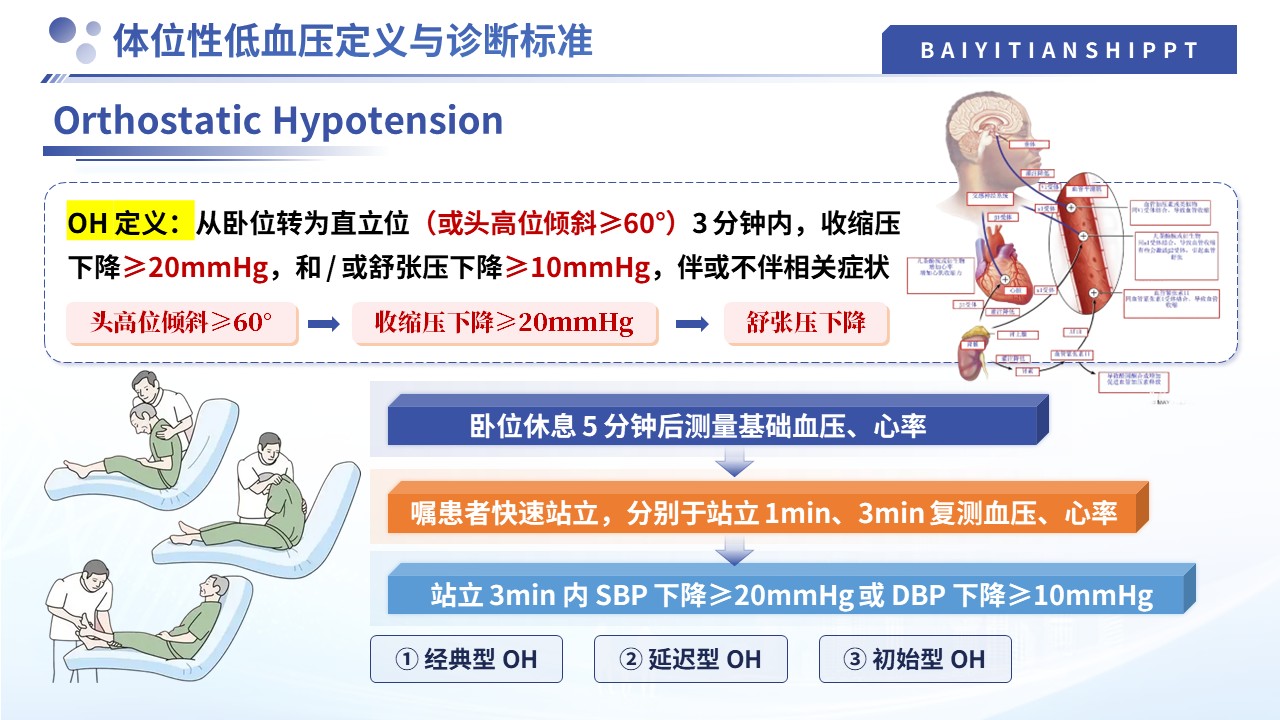 505期-护理小讲课-体位性低血压的预判与干预第4页预览