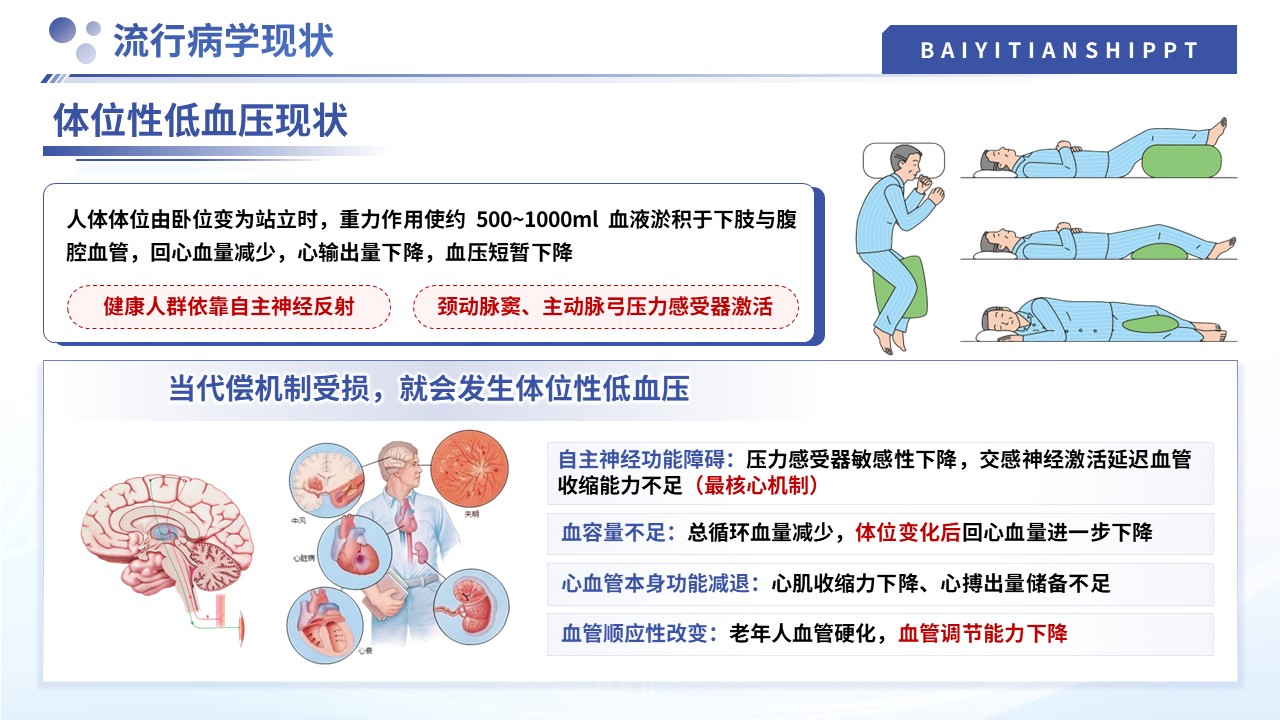 505期-护理小讲课-体位性低血压的预判与干预第6页预览