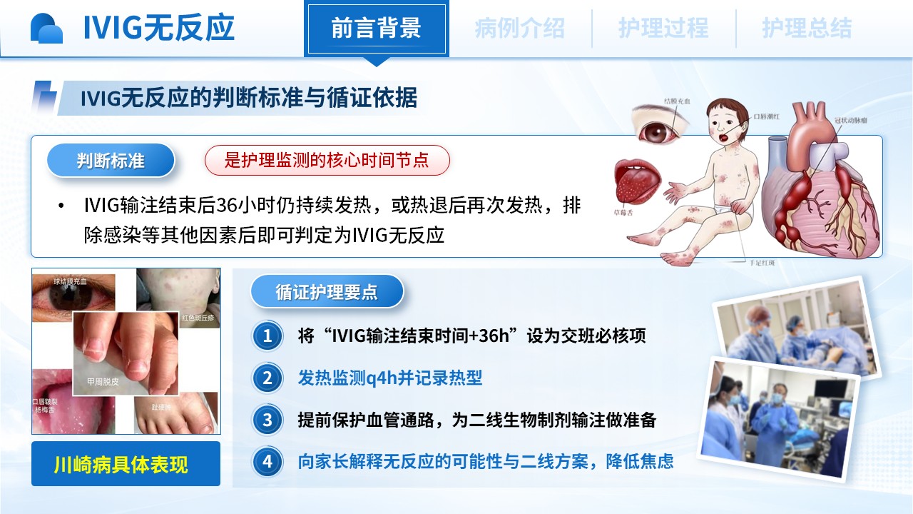 524期-护理个案-一例IVIG无反应型川崎病患儿的护理个案第4页预览