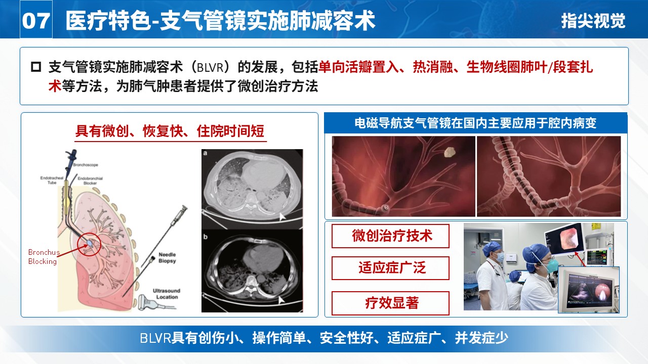 025期-呼吸内科科室主任述职答辩（蓝色）第9页预览