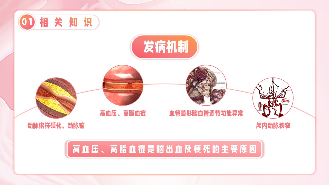 10-脑卒中护理个案第8页预览