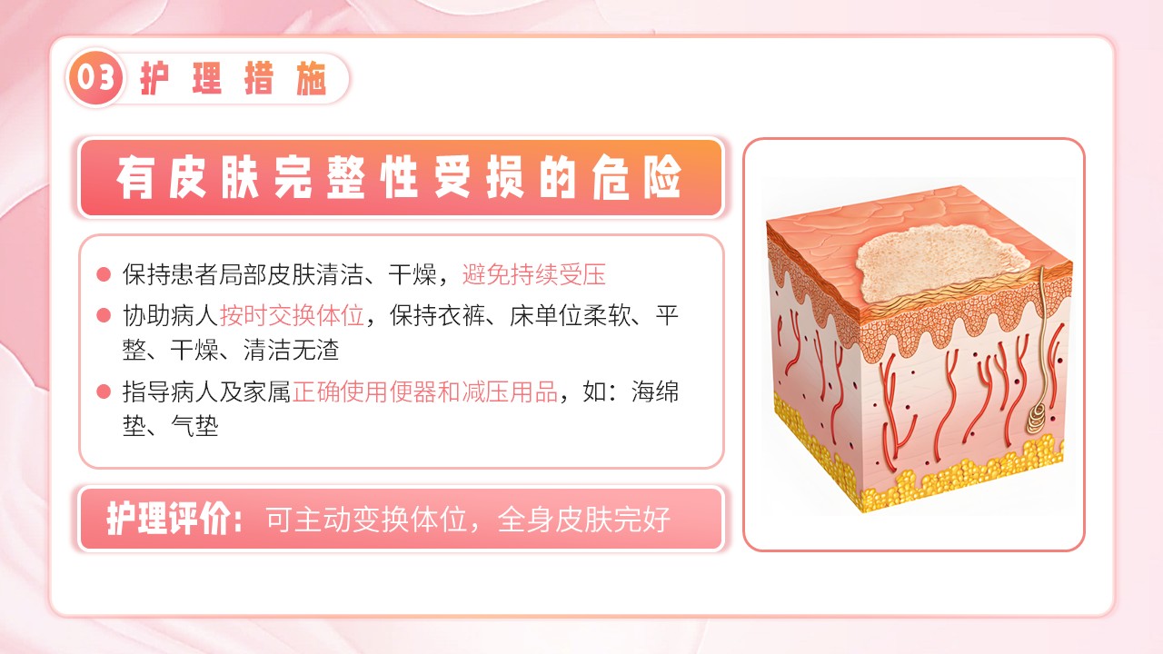 10-脑卒中护理个案第18页预览