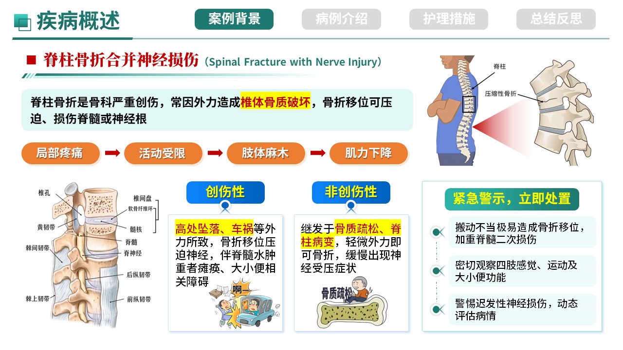 509期-护理个案-一例脊柱骨折合并神经损伤护理个案第3页预览