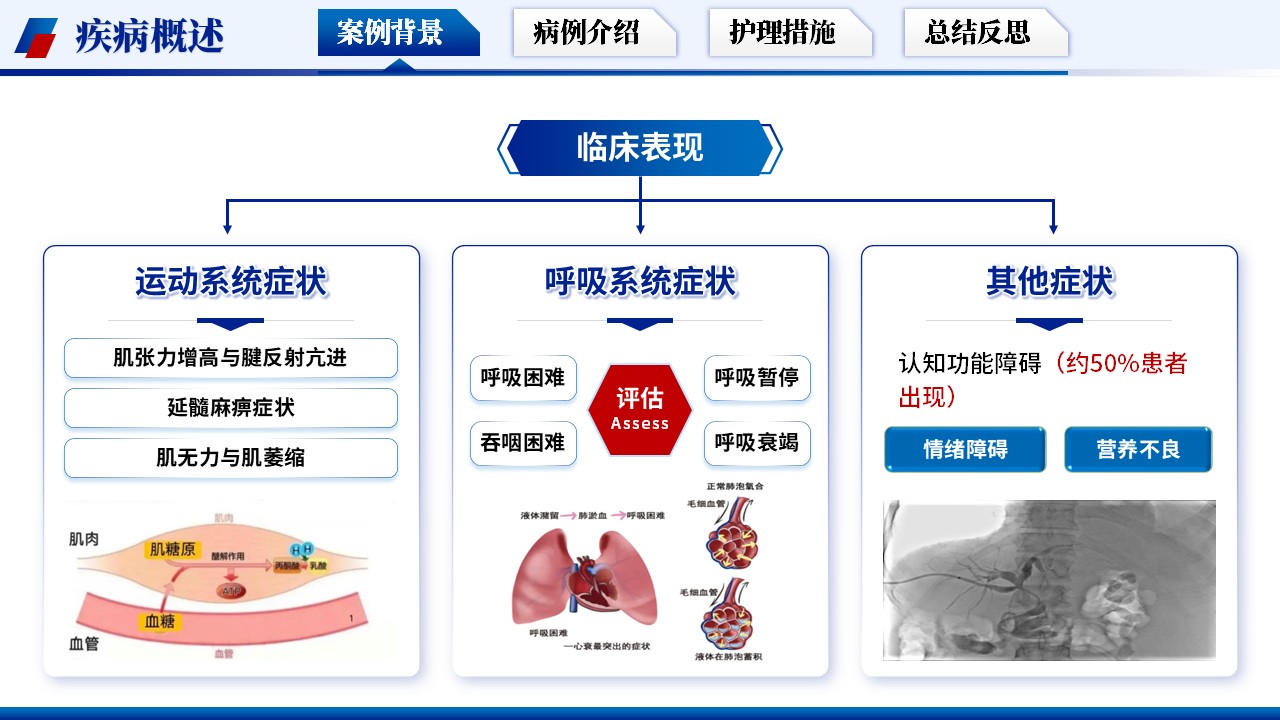 329期-护理个案-基于循证护理模式下一例渐冻症患者的护理个案第5页预览