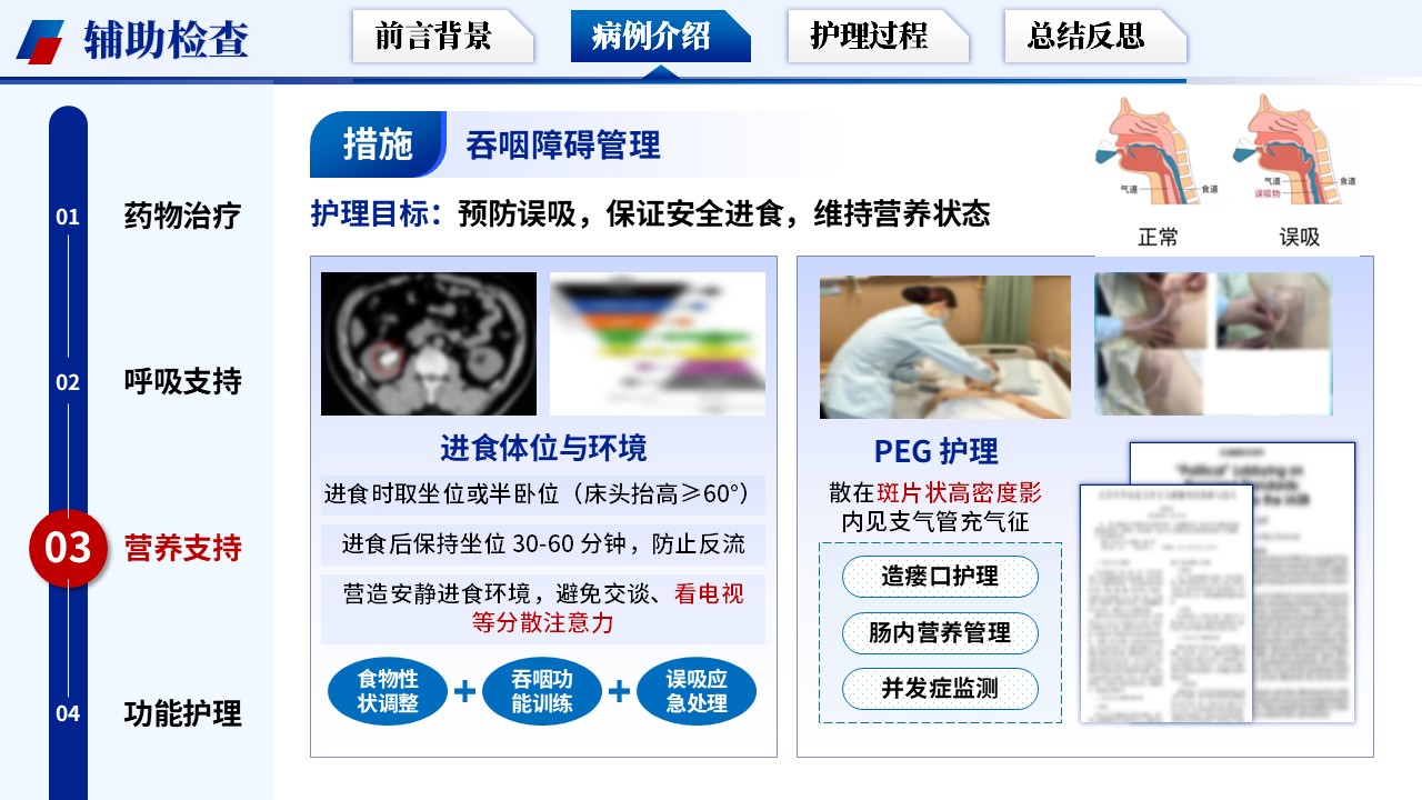 329期-护理个案-基于循证护理模式下一例渐冻症患者的护理个案第13页预览