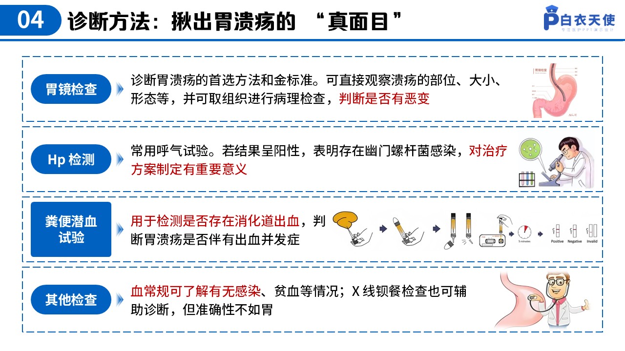 37-胃溃疡健康宣教第7页预览