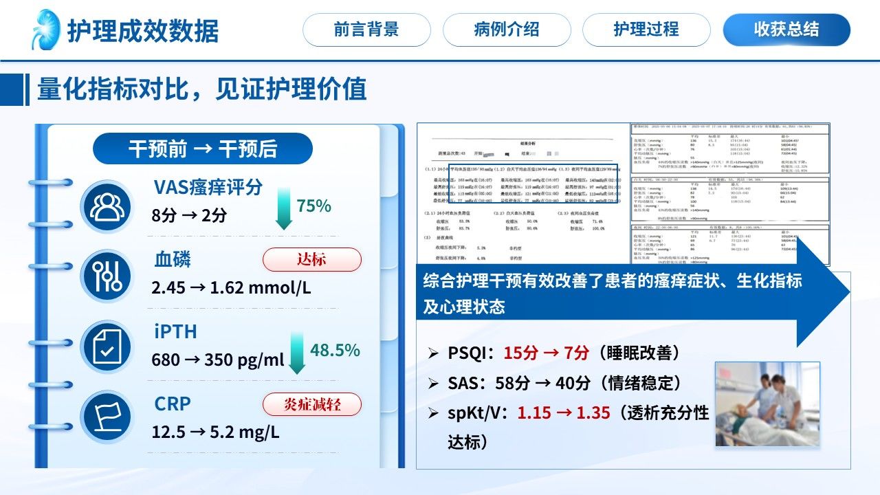 498期-护理个案-一例尿毒症皮肤瘙痒患者的护理个案第15页预览