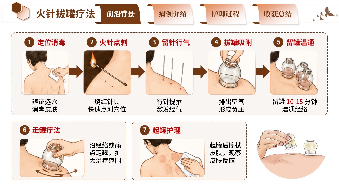 410期-疑难病例 - 一例火针拔罐干预寒湿痹阻型肩周炎肌萎缩患者护理第5页预览