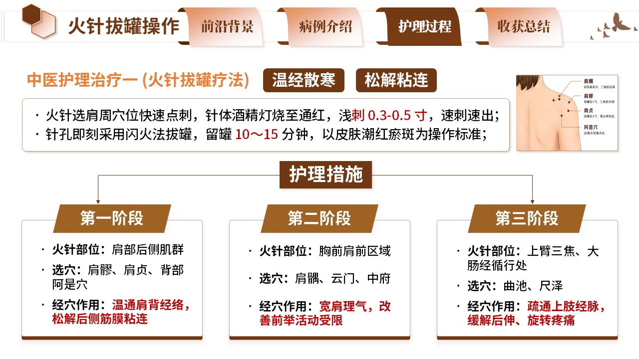 410期-疑难病例 - 一例火针拔罐干预寒湿痹阻型肩周炎肌萎缩患者护理第12页预览