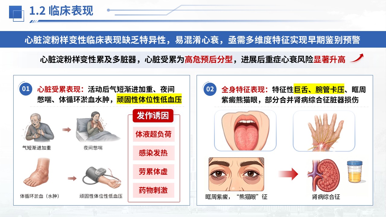 376期-护理个案-一例心脏淀粉样变性患者护理个案第4页预览
