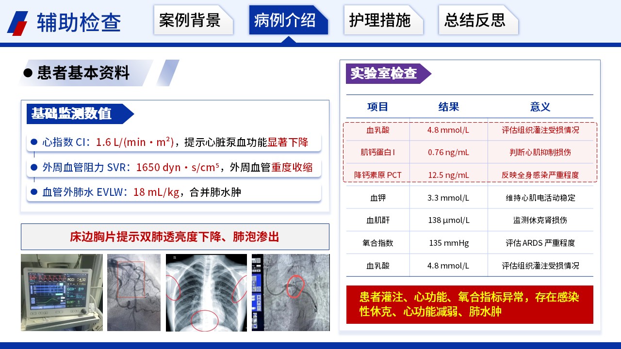 411期-护理个案 - 一例休克患者有创血流动力学精准监测护理个案第7页预览