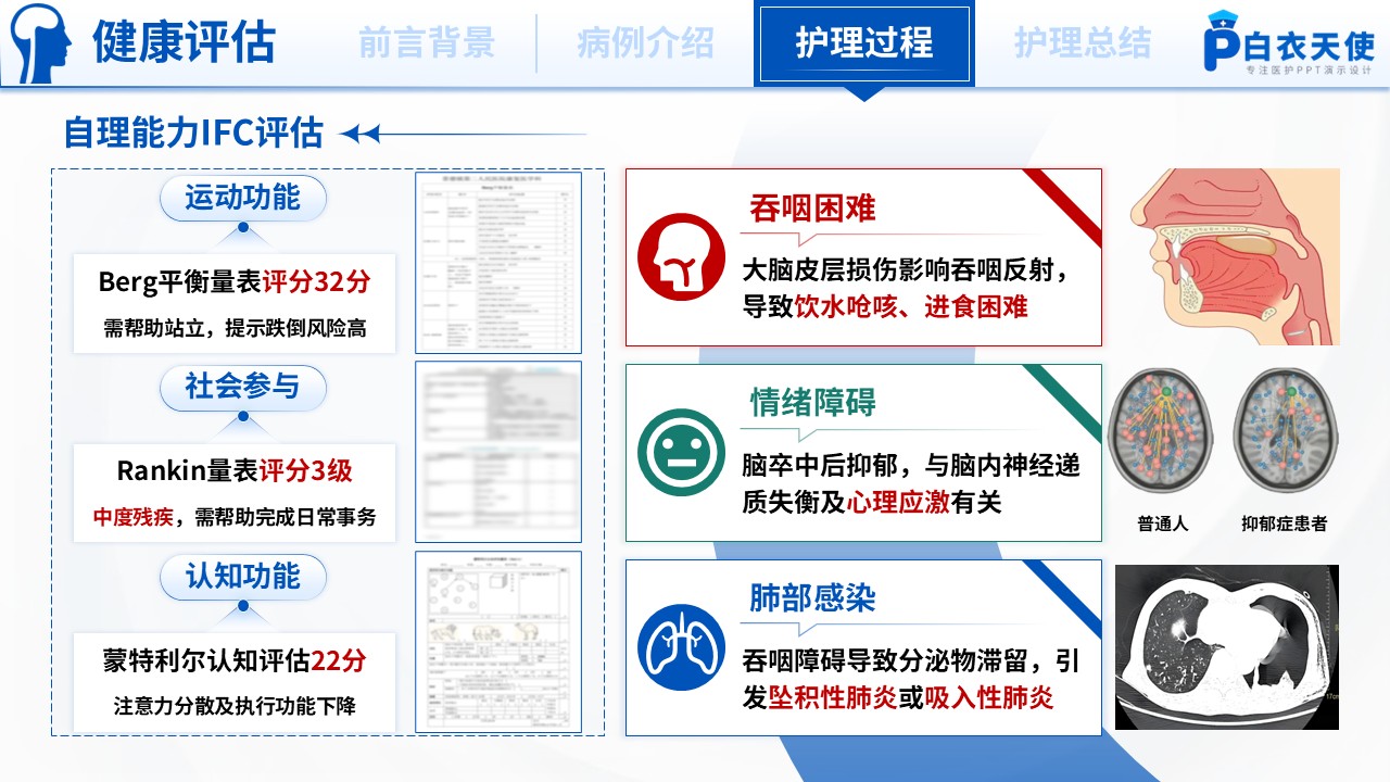176期-护理个案-基于循证的脑卒中患者的个案护理第9页预览
