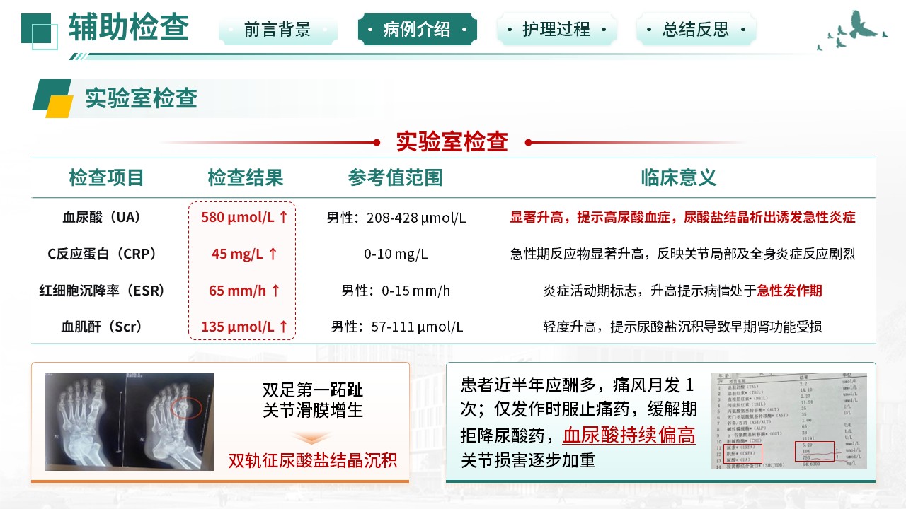 516期-疑难病例-痛风性关节炎反复急性发作疑难病例第7页预览
