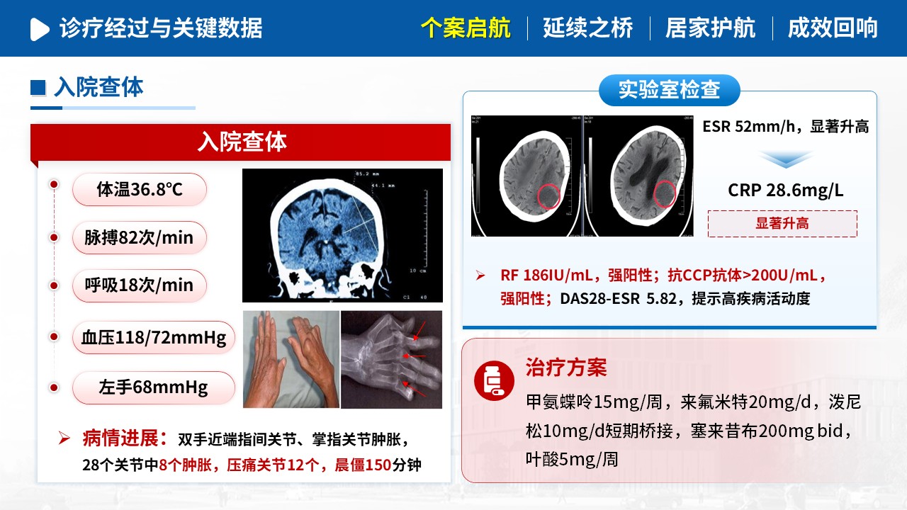 484期-护理个案-一例类风湿关节炎患者延续性护理个案第6页预览