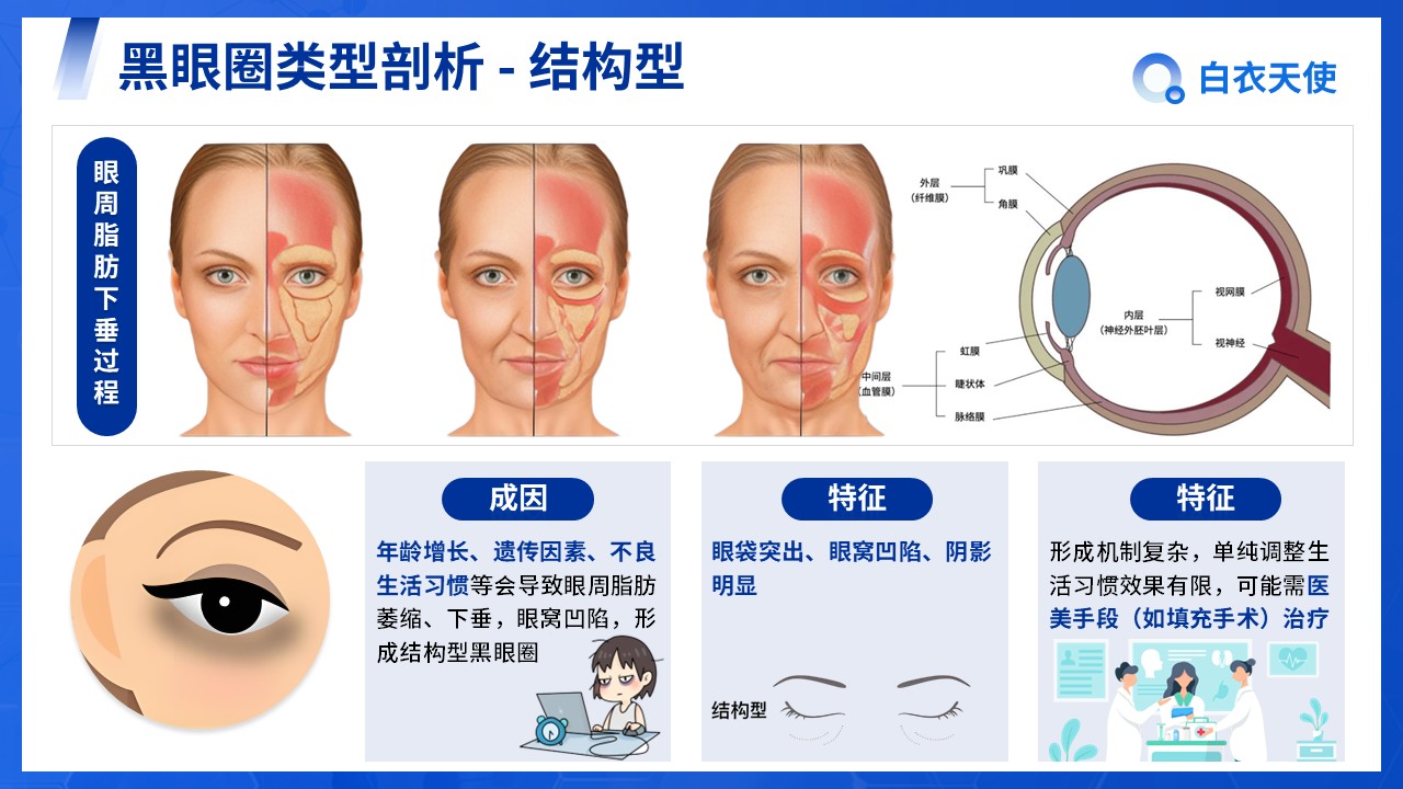 07-告别熊猫眼健康宣教第9页预览