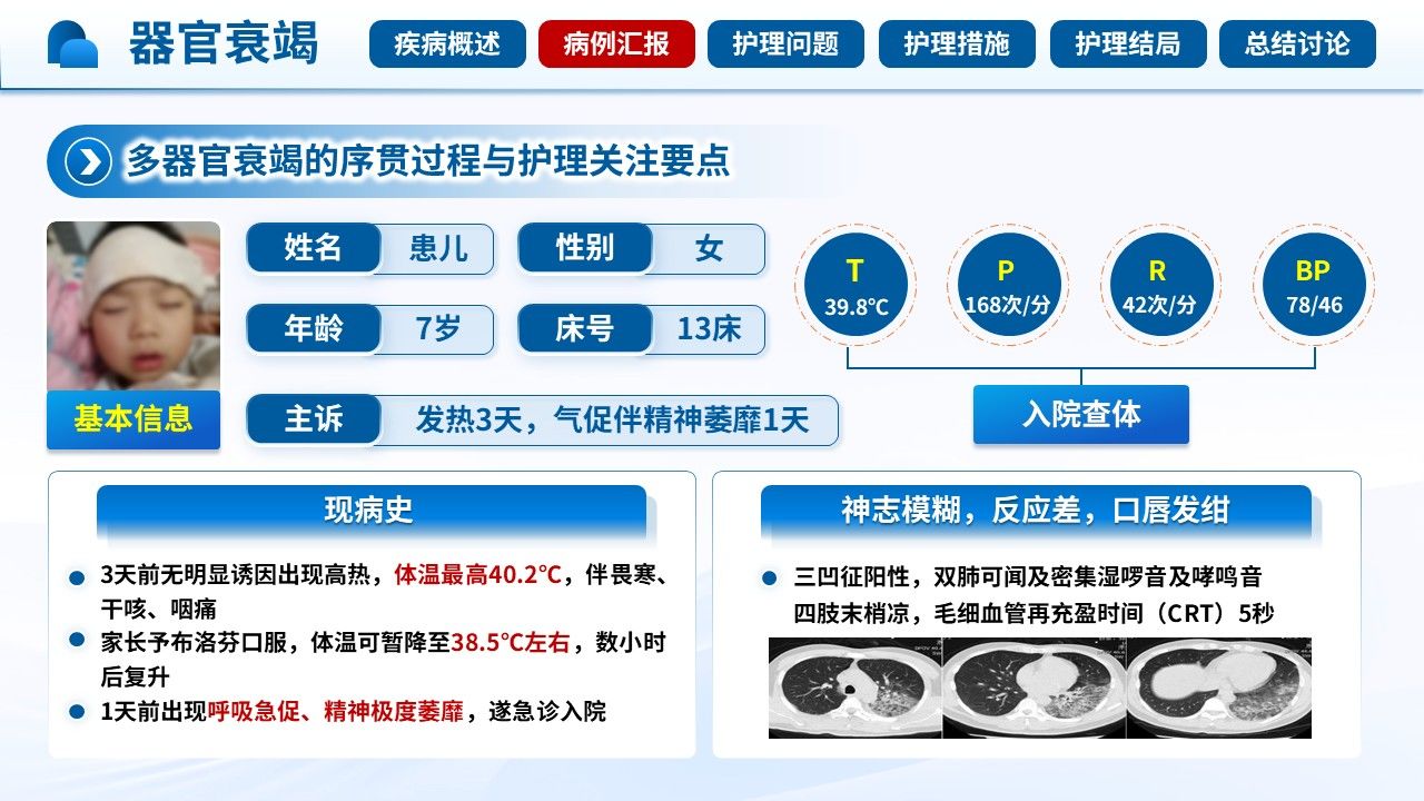 518期-护理查房-一例儿童甲型流感合并多器官衰竭的护理查房第6页预览