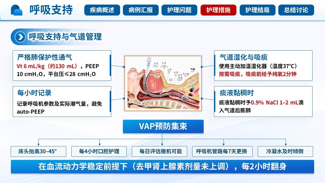 518期-护理查房-一例儿童甲型流感合并多器官衰竭的护理查房第11页预览