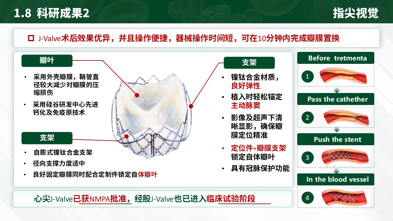 06期-心血管科室介绍（绿色）第10页预览