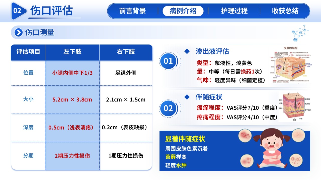 295期-护理新技术-湿疹伤口专科护理第7页预览