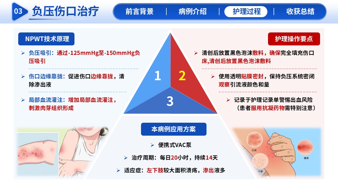 295期-护理新技术-湿疹伤口专科护理第9页预览