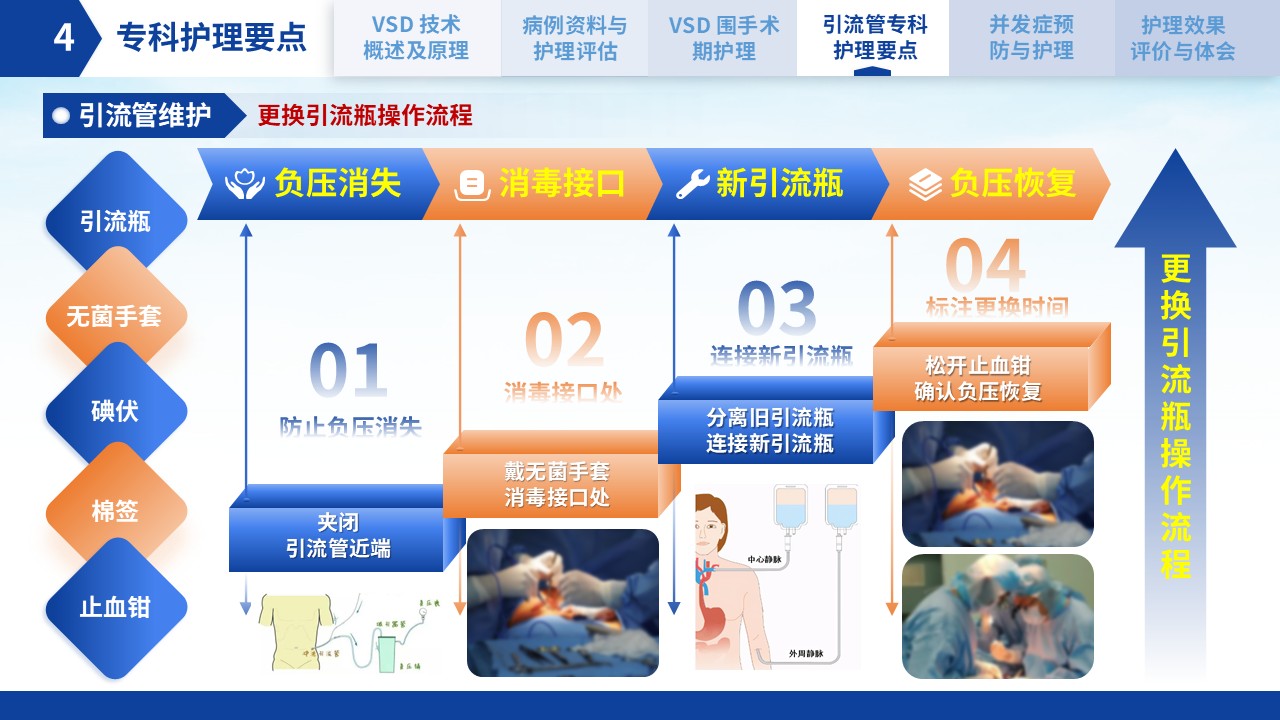 300期-护理个案-VSD引流管在创面修复中的应用及护理第14页预览