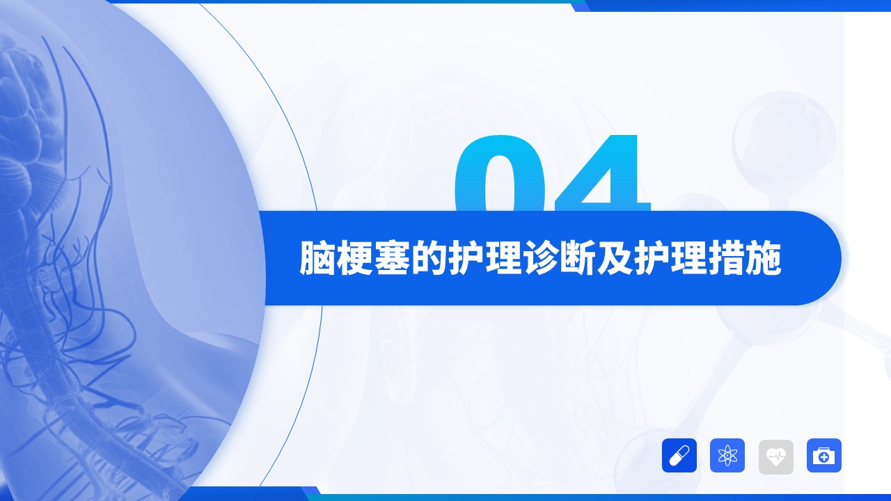88-脑梗塞病人的护理查房第11页预览