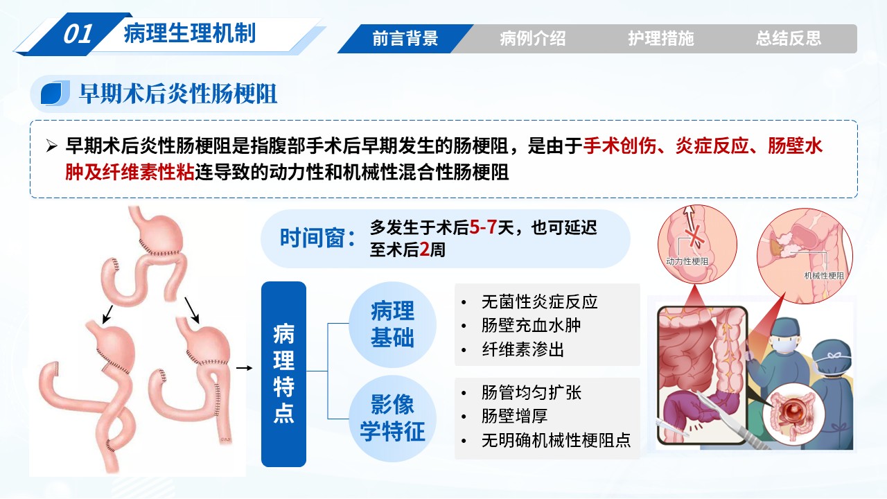 314期-疑难病例-1例胃癌术后并发肠梗阻患者的护理措施第3页预览