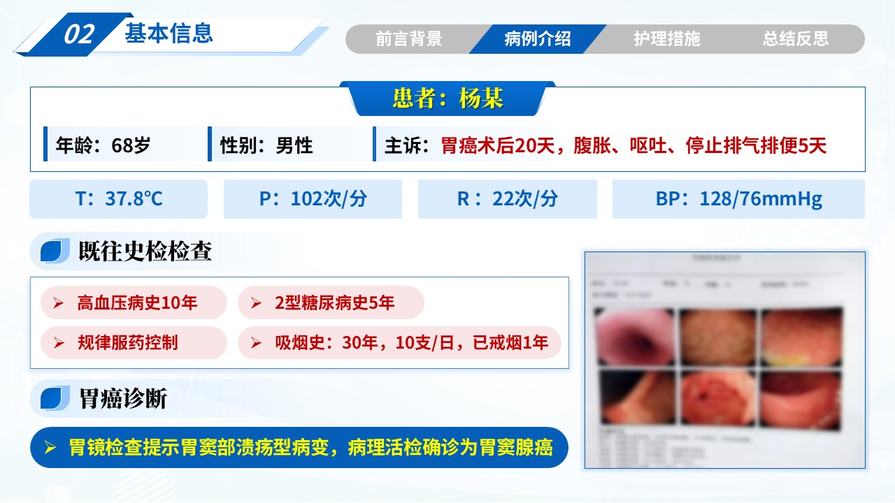 314期-疑难病例-1例胃癌术后并发肠梗阻患者的护理措施第5页预览